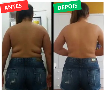 ANTES